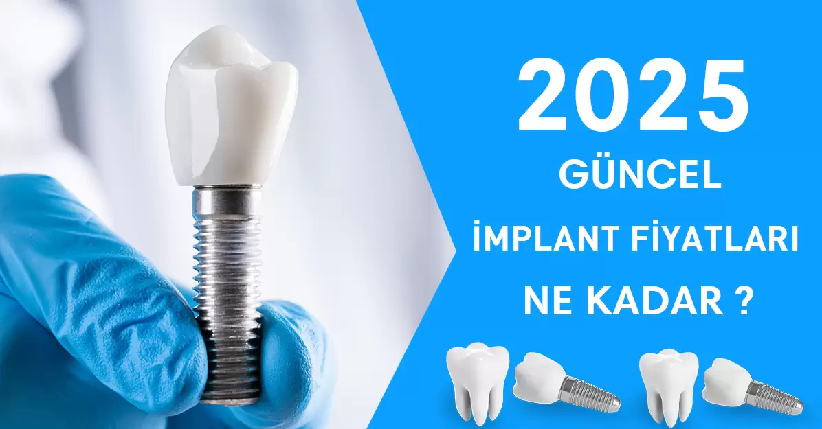 Türkiye’de İmplant Fiyatlarında 2025 Güncellemesi: Uzmanlardan Açıklama
