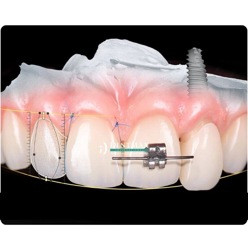 ürkiye’nin İlk Dijital Diş Sağlığı Platformu Tanıtıldı: Sektörde Devrim
