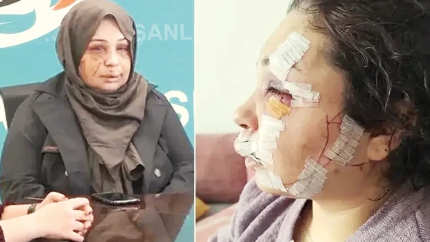 Eşe işkenceye ödül gibi ceza