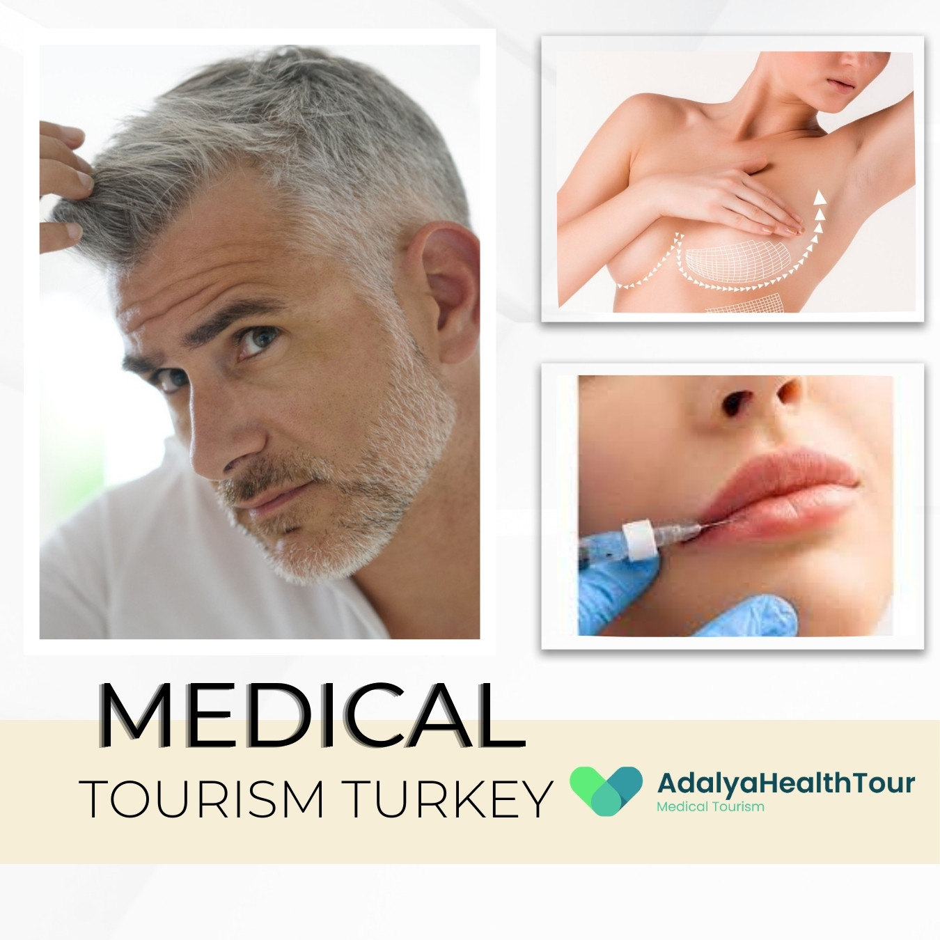 Estetik Cerrahi Turizminde Türkiye Dünya İlk Üçte